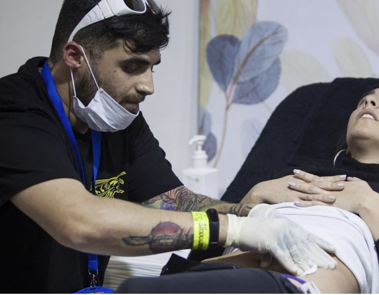 eliminación de tatuajes